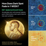 Melatoning Oneday Ampoule Serum (EGF 5x) - EASYDEW