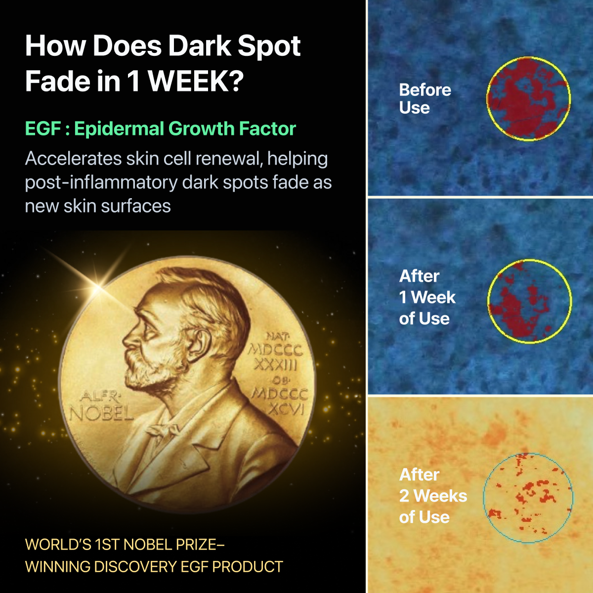 Melatoning Oneday Ampoule Serum (EGF 5x) - EASYDEW