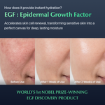 EGF Post-Laser Cream - EASYDEW