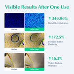 EGF Post Laser Cream - EASYDEW