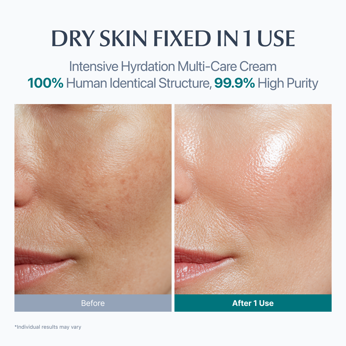 [BOGO] DW-EGF Cream Limited - EASYDEW