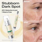[Free Gift!] Dark Spot Serum Duo - EASYDEW