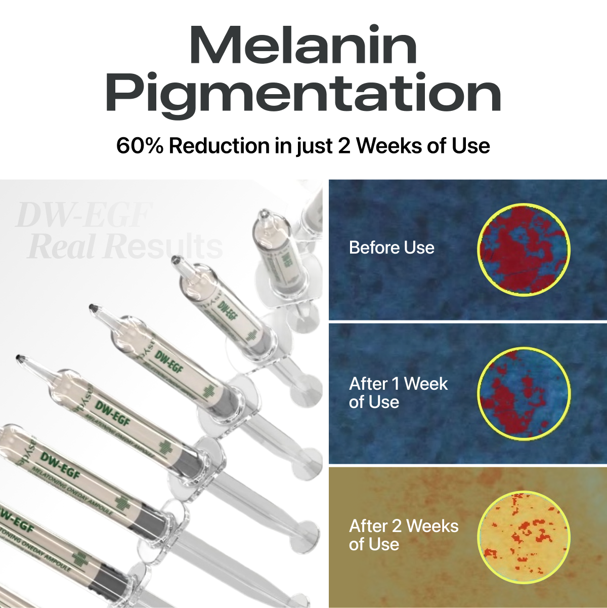 [Free Gift!] Dark Spot Serum Duo - EASYDEW